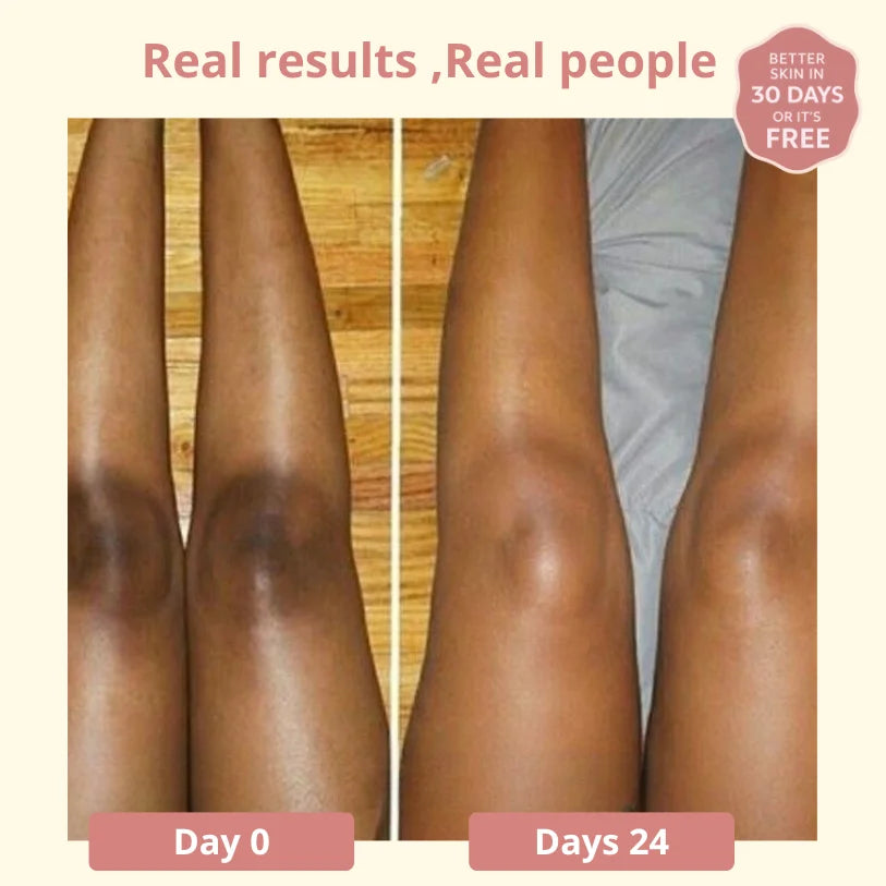 Dark Spot SERUM VITAMIN C