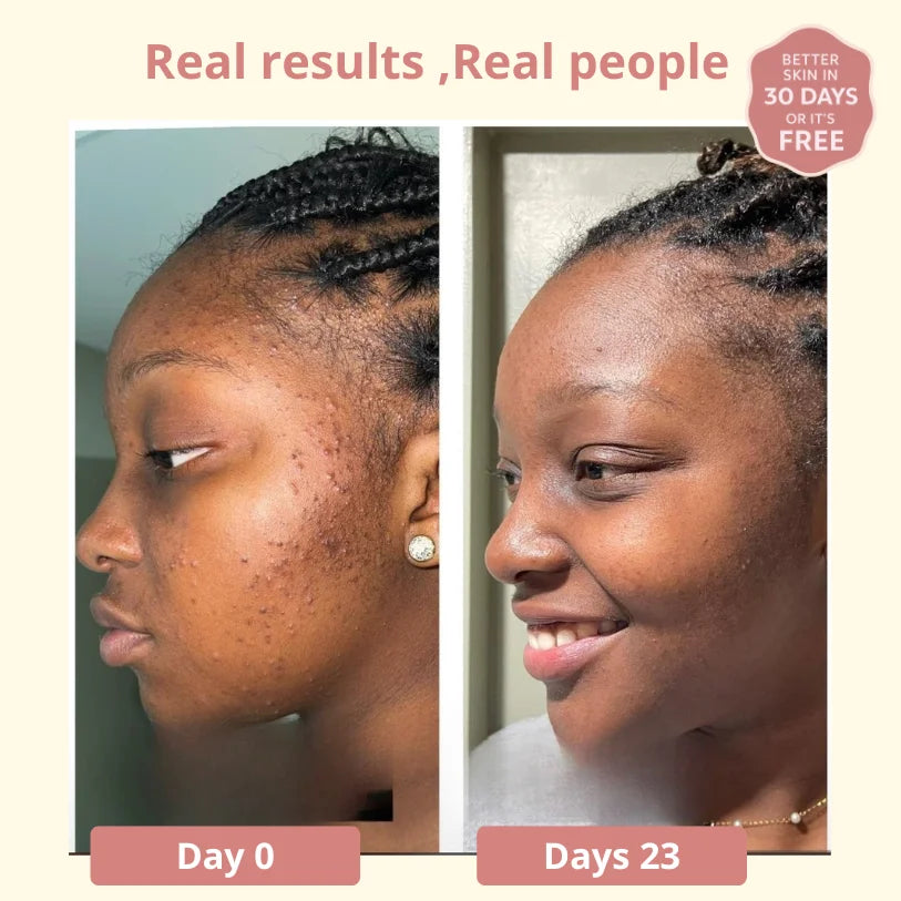 Dark Spot SERUM VITAMIN C