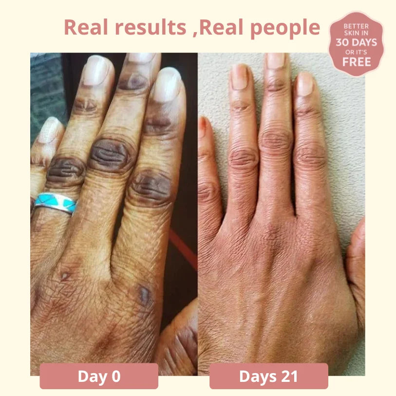 Dark Spot SERUM VITAMIN C