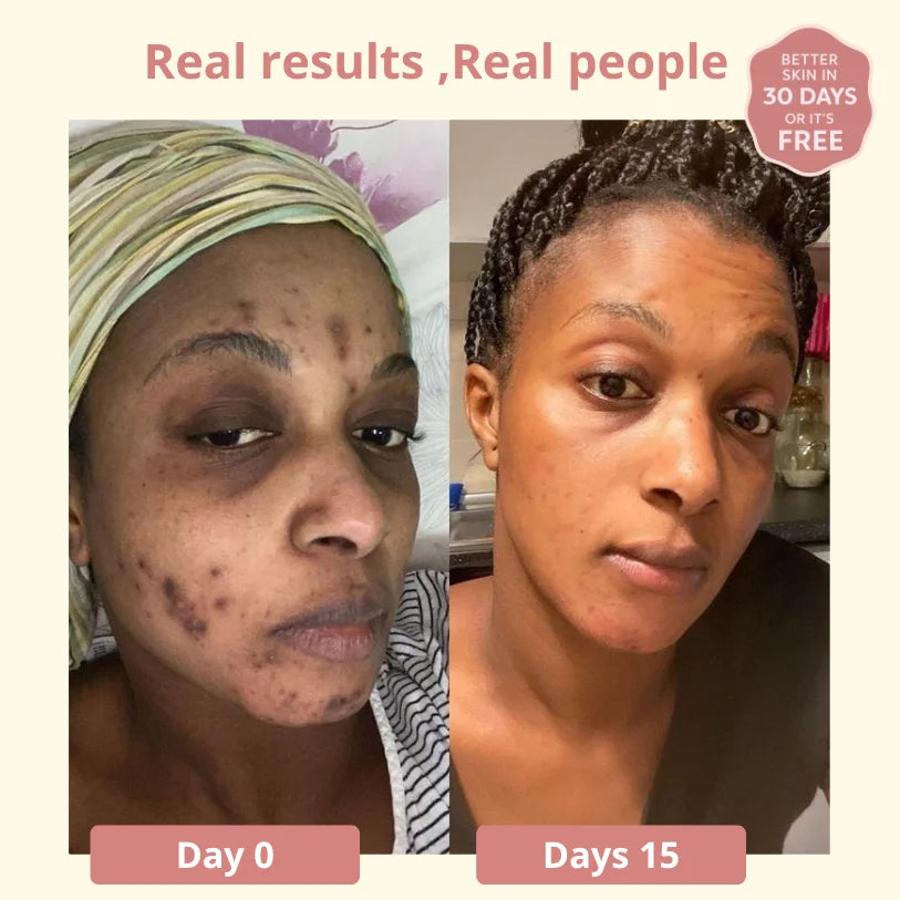 Dark Spot SERUM VITAMIN C