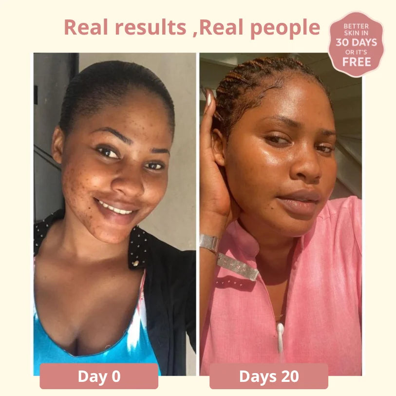 Dark Spot SERUM VITAMIN C