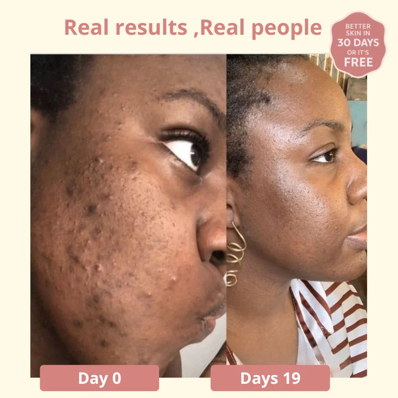 Dark Spot SERUM VITAMIN C